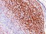 CD35 / CR1(E11), Biotin conjugate, 0.1mg/mL