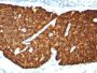 Chromogranin A(CHGA/413), Biotin conjugate, 0.1mg/mL