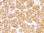 Renal Cell Carcinoma (Carbonic Anhydrase IX)(PN-15), Biotin conjugate, 0.1mg/mL