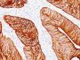Cytokeratin 8(K8.8), Biotin conjugate, 0.1mg/mL