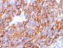 MART-1 / Melan-A(M2-7C10 + M2-9E3 + A103), Biotin conjugate, 0.1mg/mL