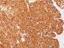 Melanoma Marker(HMB45 + M2-7C10 + M2-9E3 + T311), Biotin conjugate, 0.1mg/mL