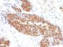 Mucin 1 / EMA / Episialin / CD227(MUC1/845), Biotin conjugate, 0.1mg/mL