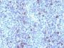 Glypican-3(GPC3/863), Biotin conjugate, 0.1mg/mL