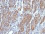 Myosin, Smooth Muscle Heavy Chain(SMMS-1), Biotin conjugate, 0.1mg/mL