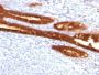 Cytokeratin 7(KRT7/760 + KRT7/903), Biotin conjugate, 0.1mg/mL