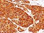 Tyrosinase(T311 + OCA1/812), Biotin conjugate, 0.1mg/mL