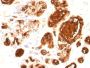 MUC1 / EMA / CD227 (Epithelial Marker) (rMUC1/960),  Biotin conjugate, 0.1mg/mL