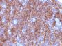 Chromogranin A(CGA414 + CGA/777 + CGA/798), Biotin conjugate, 0.1mg/mL