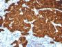 Chromogranin A(CGA414 + CGA/777 + CGA/798), Biotin conjugate, 0.1mg/mL