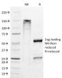 ETS1 / (Marker of Tumor Metastasis) (ETS1/1282), Biotin conjugate, 0.1mg/mL