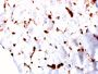FABP5 (Marker of Metastatic Potential in Colorectal Cancer)(CPTC-FABP5-3), Biotin conjugate, 0.1mg/mL
