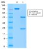 TRAcP (Tartrate-Resistant Acid Phosphatase) (Hairy Cell Leukemia Marker) (rACP5/1070), Biotin conjugate, 0.1mg/mL