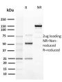 Cyclin E (G1/S-Phase Cyclin) (CCNE1/2460), Biotin conjugate, 0.1mg/mL