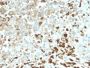 NGF-Receptor (p75) / CD271 (Soft Tissue Tumor Marker) (NGFR/2550R), Biotin conjugate, 0.1mg/mL