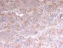 Adipophilin / Perilipin-2 (Marker of Lipid Accumulation)(rADFP/1493), Biotin conjugate, 0.1mg/mL