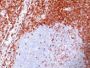 bcl-2(100/D5), 0.2mg/mL