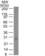 bcl-2(100/D5), 0.2mg/mL
