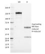 CD19(CVID3/155), 0.2mg/mL