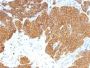 PTH / Parathyroid Hormone (N-Terminal)(3H9), 0.2mg/mL