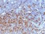 Human IgG Immunoglobulin(IG266), 0.2mg/mL