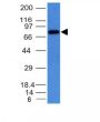 Human IgM Immunoglobulin(IM373), 0.2mg/mL