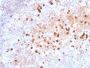 Human IgM Immunoglobulin(IM373), 0.2mg/mL