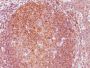 BCL-10(BL10/411), 0.2mg/mL