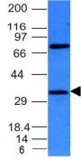 BCL-10(BL10/411), 0.2mg/mL