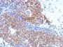 Topoisomerase (DNA) I, Mitochondrial (TOP1MT)(TOP1MT/568), 0.2mg/mL