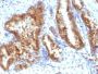 AMACR / p504S(Rabbit PAb), 0.2mg/mL