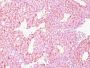 Chromogranin A(CHGA/798), 0.2mg/mL