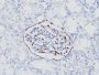 WT1 (Wilm's Tumor 1)(6F-H2), 0.2mg/mL