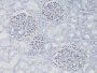WT1 (Wilm's Tumor 1)(WT1/857), 0.2mg/mL