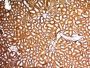 WT1 (Wilm's Tumor 1)(WT1/857), 0.2mg/mL