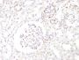 WT1 (Wilm's Tumor 1)(WT1/857), 0.2mg/mL