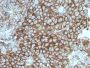 Melanoma Marker(KBA.62), 0.2mg/mL