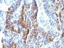 Melanoma Marker(KBA.62), 0.2mg/mL