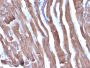 Muscle Specific Actin(HHF35 + MSA/953), 0.2mg/mL