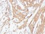 Muscle Specific Actin(HHF35 + MSA/953), 0.2mg/mL