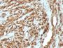 Muscle Specific Actin(HHF35 + MSA/953), 0.2mg/mL