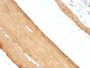 Muscle Specific Actin(HHF35 + MSA/953), 0.2mg/mL