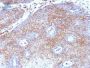 Beta-2-Microglobulin (B2M)(B2M/1118), 0.2mg/mL