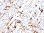 Beta-2-Microglobulin (B2M)(B2M/1118), 0.2mg/mL