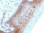 Beta-2-Microglobulin (B2M)(B2M/1118), 0.2mg/mL