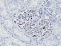 WT1 (Wilm's Tumor 1)(WT1/857 + 6F-H2), 0.2mg/mL