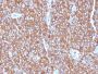 Chromogranin A(LK2H10 + PHE5 + CGA414), 0.2mg/mL