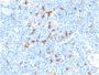 IL3RA / CD123 (Acute Myeloid Leukemia Marker) (IL3RA/1531), 0.2mg/mL