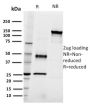 CD22 / BL-CAM (B-Cell Marker)(RFB4), 0.2mg/mL