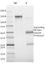Annexin A1 / (Hairy Cell Leukemia Marker)(ANXA1/1672), 0.2mg/mL